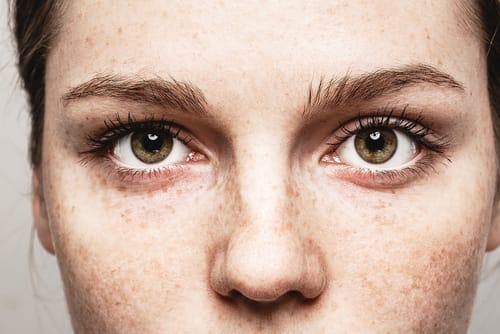 Life Skills Rehab: Making Eye Contact