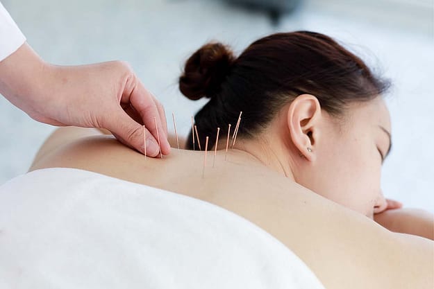 Acupuncture and Physical Therapy oregon